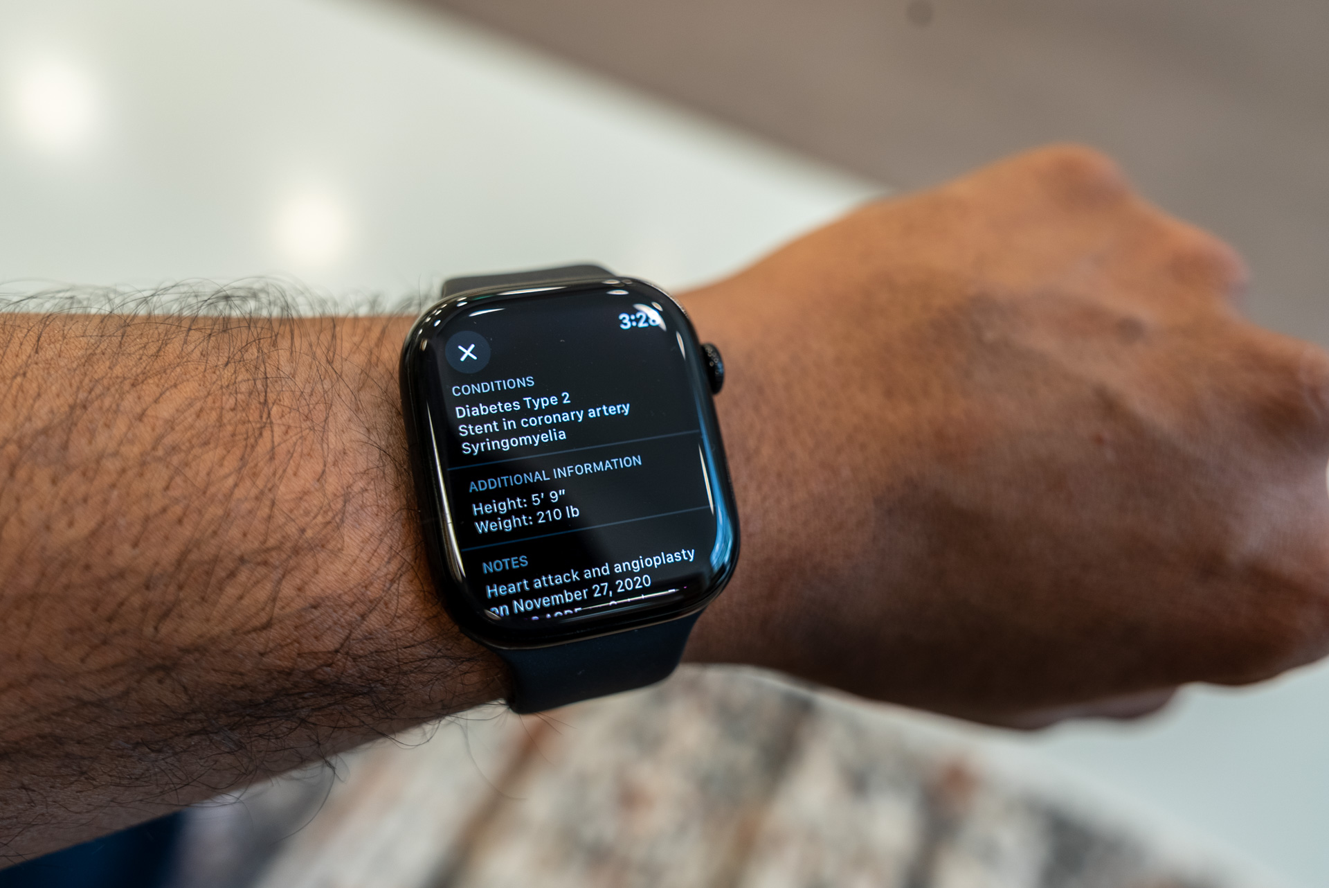 ID médical Vitals sur Apple Watch Series 10
