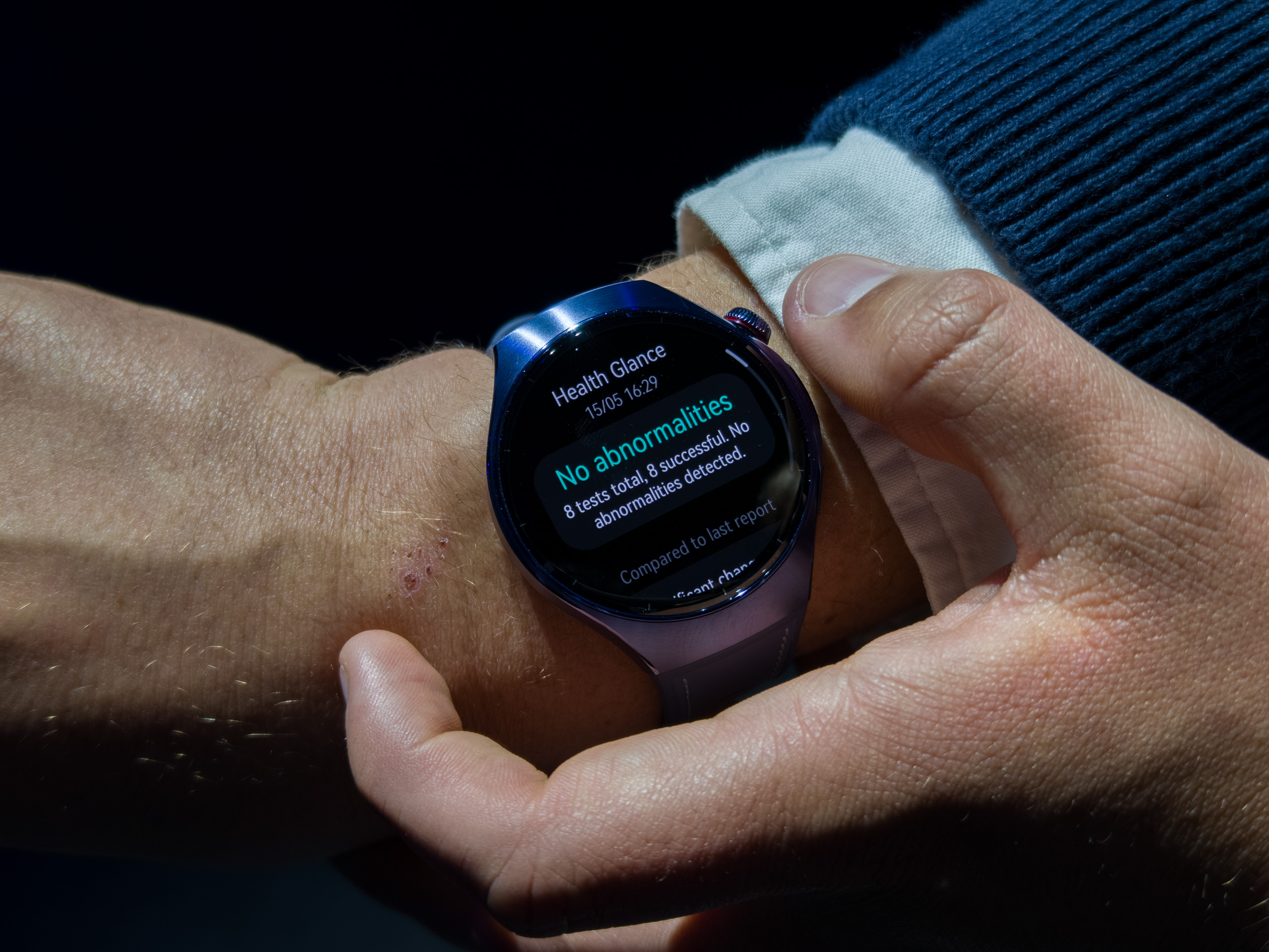Résultats de contrôle de santé de 60 secondes sur la montre Huawei 5