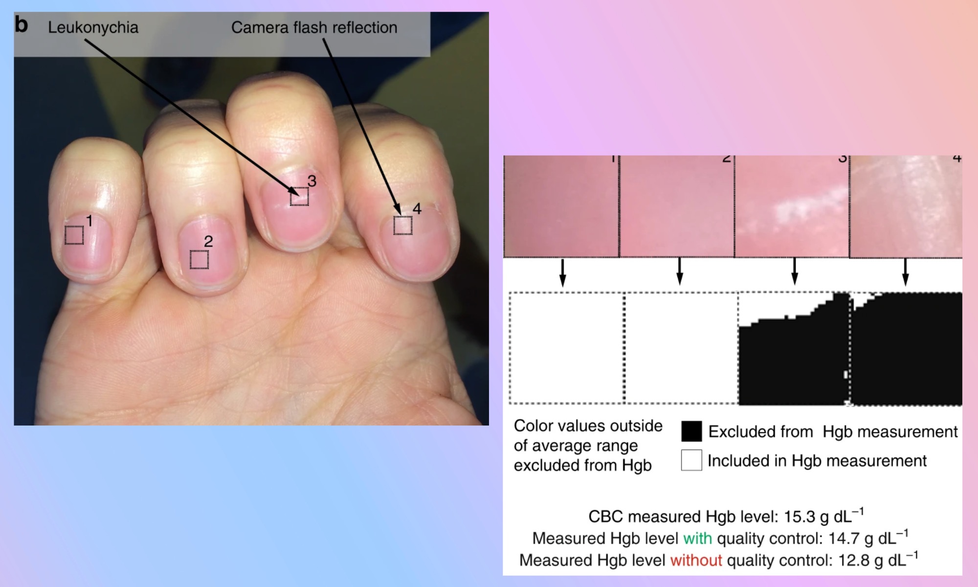 Analyse de la couleur des ongles par une application mobile.