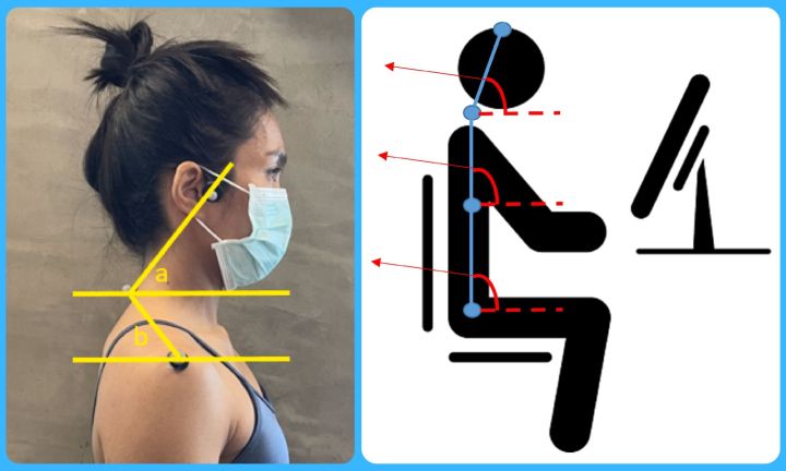 Représentation d'une mauvaise posture.